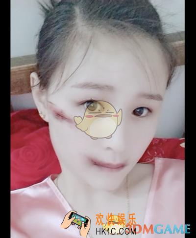 抖音受伤妆特效怎么拍_脸上受伤的妆拍摄方法介绍